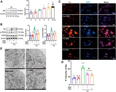 Berberine Reduces Aβ42 Deposition and Tau Hyperphosphorylation via Ameliorating Endoplasmic Reticulum Stress